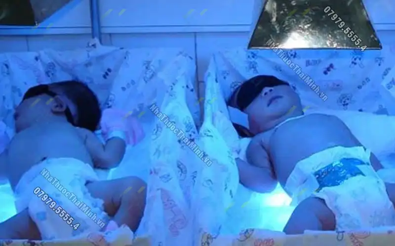 Chiếu đèn vàng da cho trẻ sơ sinh có ảnh hưởng gì không?