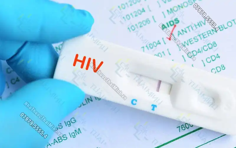Phân biệt mụn HIV với mụn thông thường