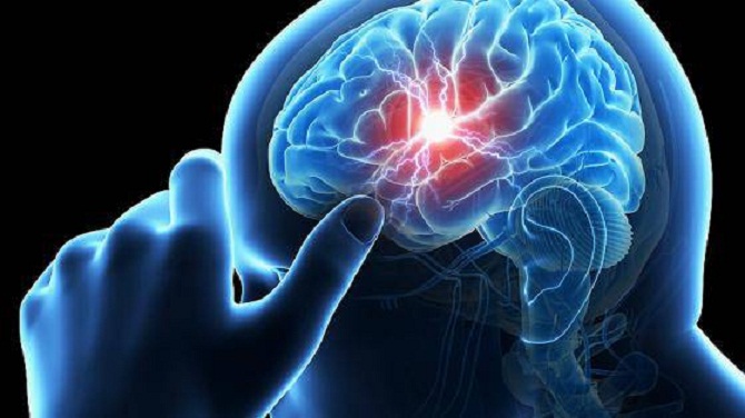 Khi máu tràn vào mô não, xuất huyết não xảy ra, là một dạng đột quỵ. Điều này gây tổn thương cho não và kích thích phản ứng viêm trong mô não, gây phù não. Một cụm máu hình thành và tạo áp lực lên mô xung quanh, dẫn đến vỡ mạch máu trong não.