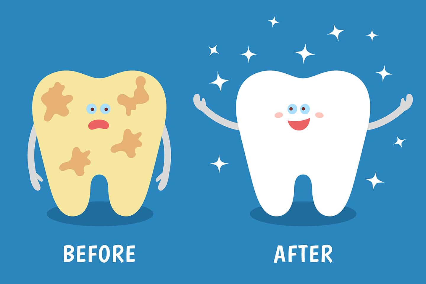 Cạo vôi răng bao lâu thì ăn được? Mới lấy vôi răng nên kiêng gì?