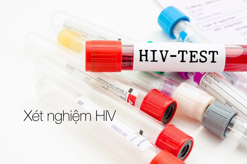 Xét nghiệm HIV là gì? Xét nghiệm HIV ở đâu uy tín?