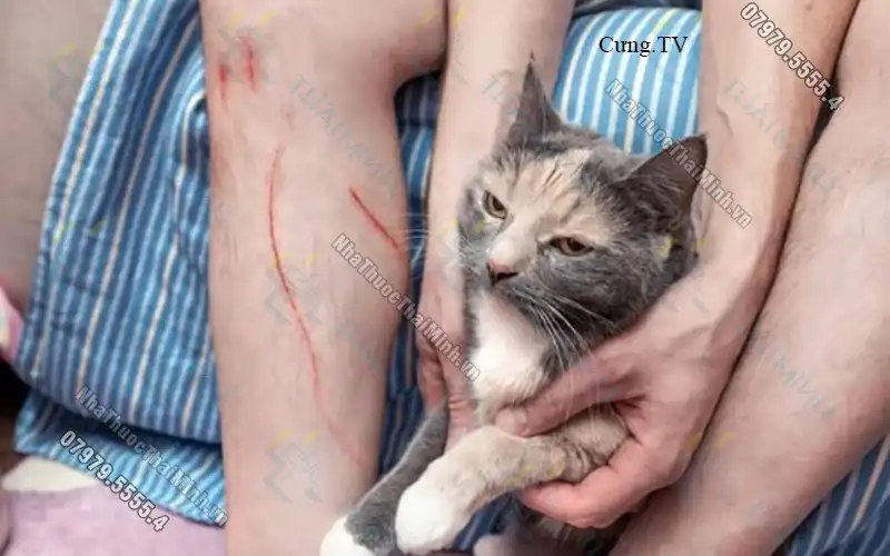 Bị mèo cào chảy máu có cần tiêm phòng không?