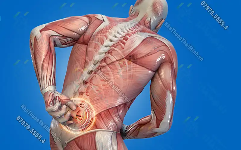 Nguyên nhân gây bệnh thoái hóa cột sống thắt lưng L3 - L4 và cách điều trị