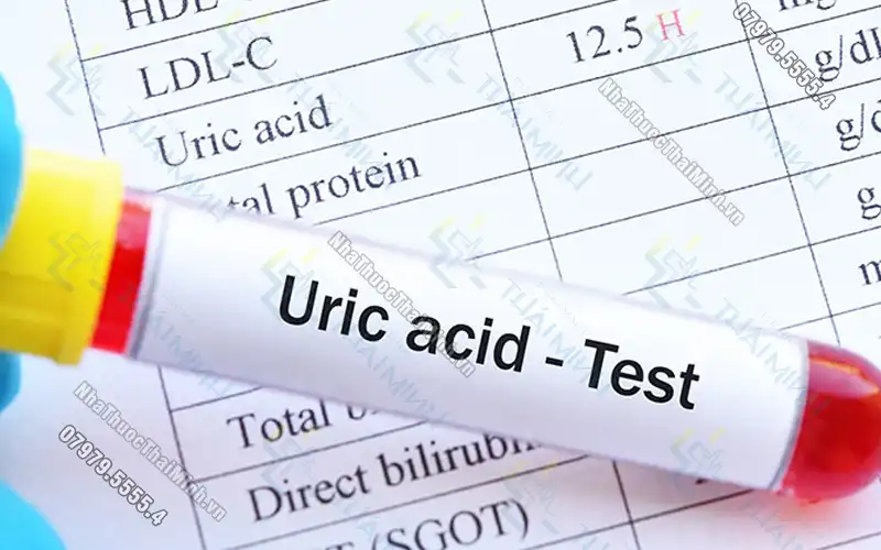 Chỉ số acid uric máu bao nhiêu là bị Gout?
