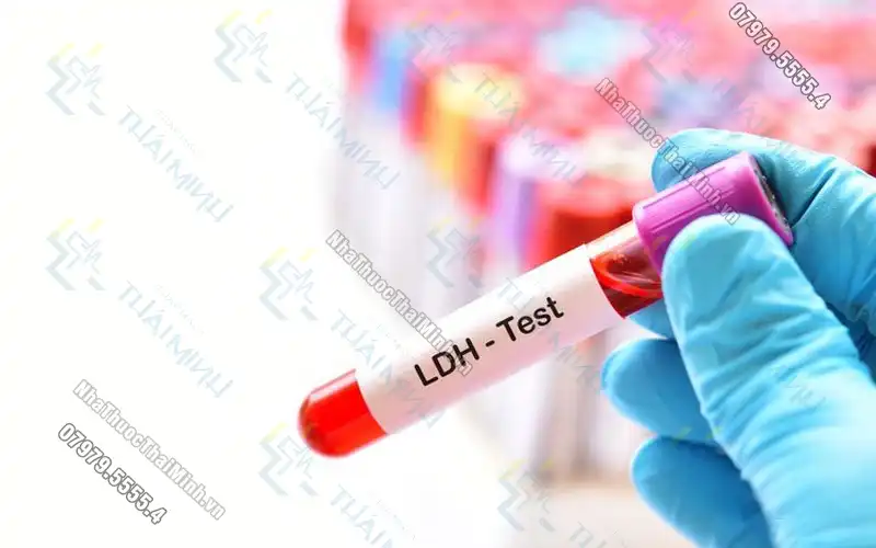 Thông tin cần biết về xét nghiệm LDH - Bạn không nên bỏ qua