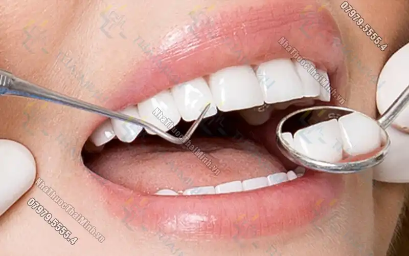 Tổng hợp những trường hợp không nên bọc răng sứ bạn cần biết