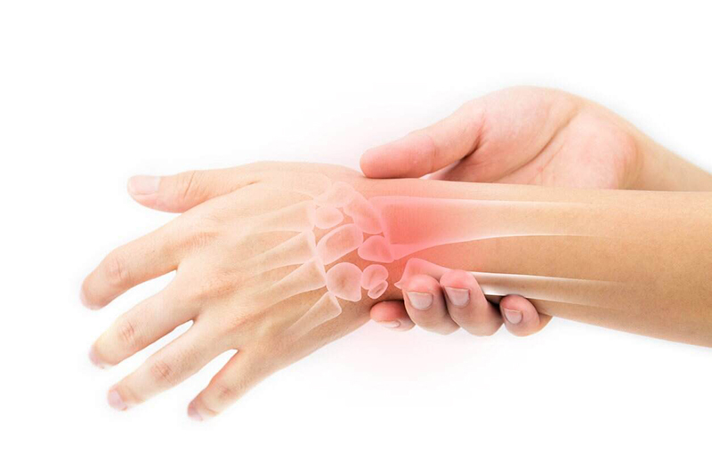 Viêm bao gân cổ tay là gì? Những điều bạn cần biết