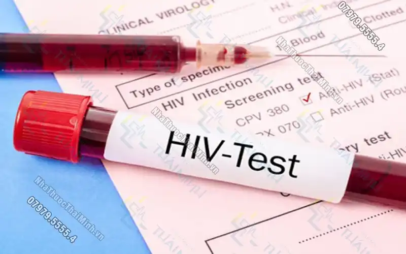 Xét nghiệm HIV là gì? Xét nghiệm HIV ở đâu uy tín?