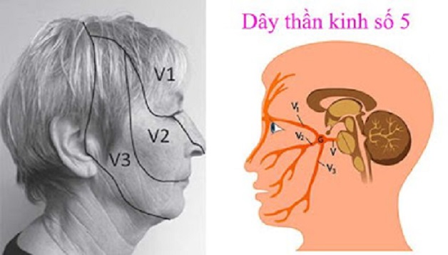 Tìm hiểu về đau dây thần kinh số 5 mà bạn chưa biết