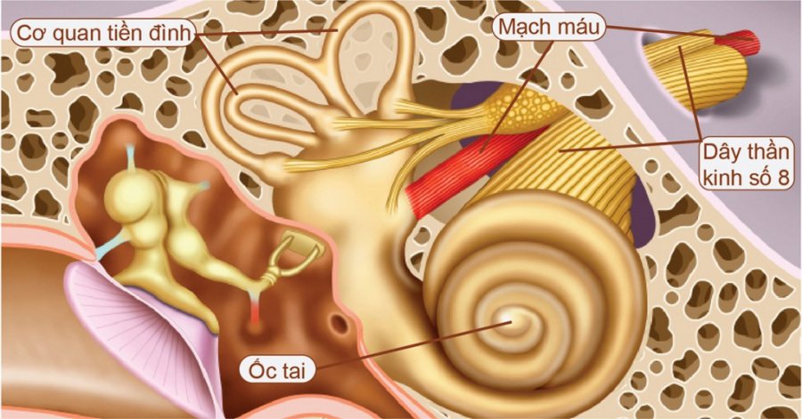 Triệu chứng và cách điều trị bệnh u dây thần kinh số 8