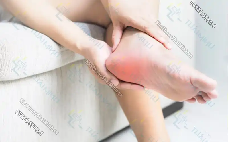 Bệnh gai gót chân là gì? Cách điều trị bệnh gai gót chân dứt điểm
