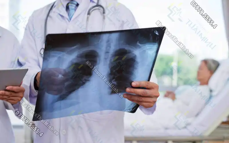 Viêm phổi cộng đồng là gì?