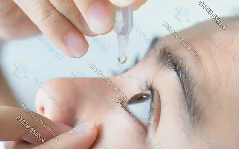 Đau mắt đỏ: Cách điều trị và phòng ngừa hiệu quả