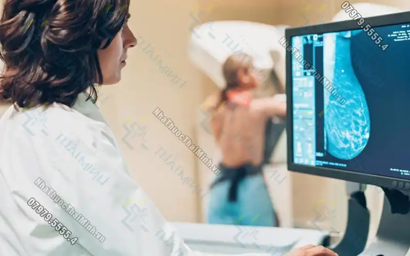 Chụp X-quang phổi là gì? Chụp X quang phổi và tất cả những điều cần biết
