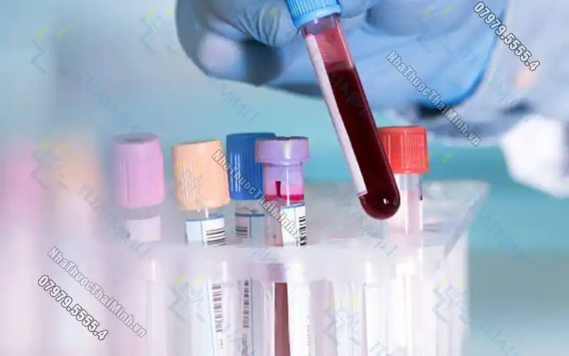 Vi khuẩn HP có đặc điểm gì? Xét nghiệm máu có phát hiện vi khuẩn HP không?